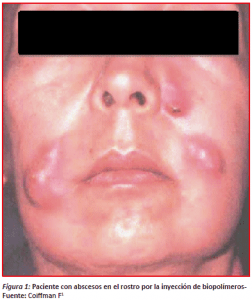 iatrogenic alogenosis