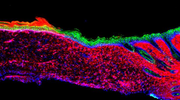 Científics espanyols regeneren la pell sense usar empelts
