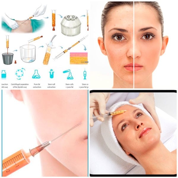 2 - Extraction et transformation des graisses 2 - Extraction et transformation des graisses
