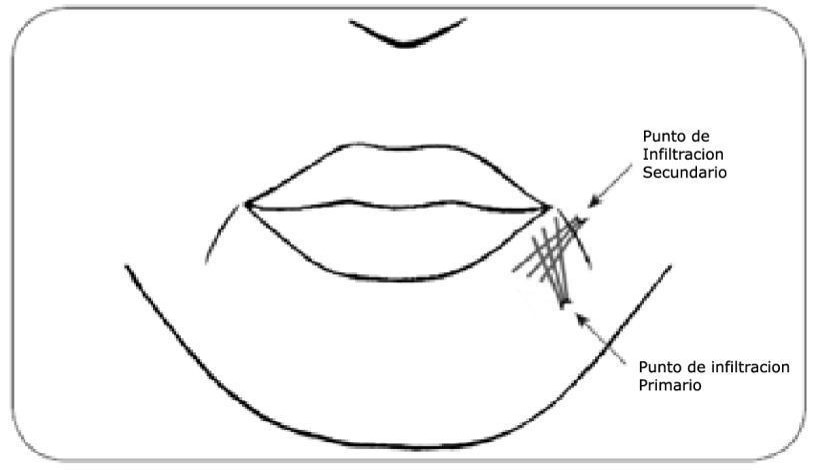 Gráfico relleno líneas de marioneta